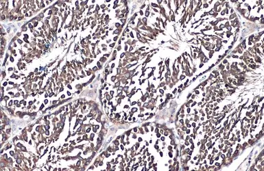 Anti-Grp78 antibody [N2C1], Internal used in IHC (Paraffin sections) (IHC-P). GTX102580
