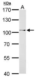 Anti-CtBP2 antibody used in Western Blot (WB). GTX102582