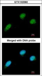 Anti-CtBP2 antibody used in Immunocytochemistry/ Immunofluorescence (ICC/IF). GTX102582