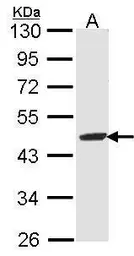 Anti-FAH antibody used in Western Blot (WB). GTX102583