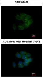 Anti-MRCK alpha antibody used in Immunocytochemistry/ Immunofluorescence (ICC/IF). GTX102598