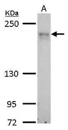 Anti-MRCK alpha antibody used in Western Blot (WB). GTX102598