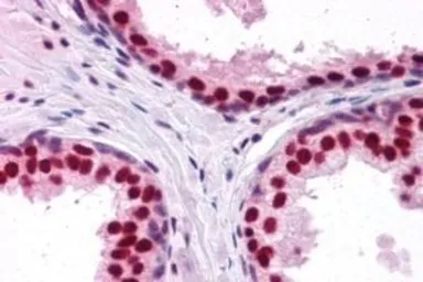 Anti-DDX5 antibody, C-term used in IHC (Paraffin sections) (IHC-P). GTX10261