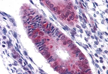 Anti-DDX5 antibody, C-term used in IHC (Paraffin sections) (IHC-P). GTX10261