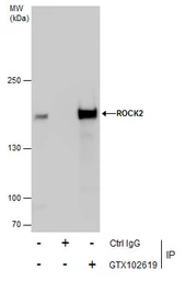Anti-ROCK2 antibody used in Immunoprecipitation (IP). GTX102619