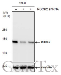 Anti-ROCK2 antibody used in Western Blot (WB). GTX102619