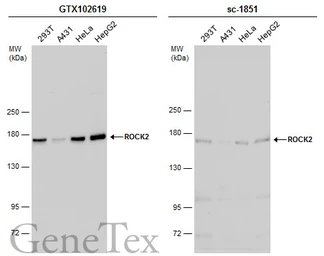 Anti-ROCK2 antibody used in Western Blot (WB). GTX102619