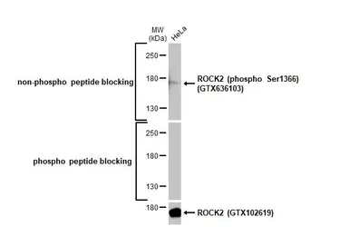 Anti-ROCK2 antibody used in Western Blot (WB). GTX102619