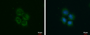 Anti-ROCK2 antibody used in Immunocytochemistry/ Immunofluorescence (ICC/IF). GTX102619