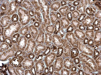 Anti-ROCK2 antibody used in IHC (Paraffin sections) (IHC-P). GTX102619