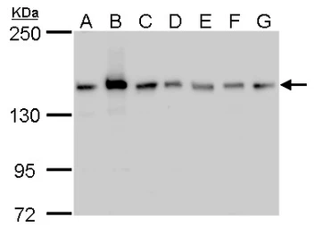 Anti-ROCK2 antibody used in Western Blot (WB). GTX102619