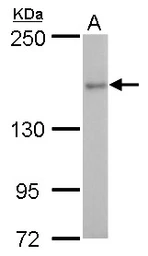 Anti-ROCK2 antibody used in Western Blot (WB). GTX102619