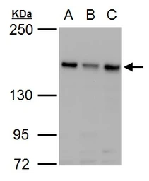 Anti-ROCK2 antibody used in Western Blot (WB). GTX102619