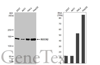 Anti-ROCK2 antibody used in Western Blot (WB). GTX102619