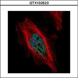 Anti-DYRK1B antibody used in Immunocytochemistry/ Immunofluorescence (ICC/IF). GTX102623