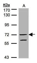 Anti-RAPGEF5 antibody used in Western Blot (WB). GTX102629