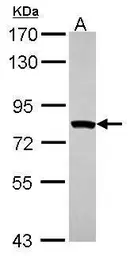 Anti-MTMR2 antibody [C1C3] used in Western Blot (WB). GTX102633