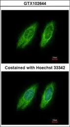 Anti-GBF1 antibody [N1], N-term used in Immunocytochemistry/ Immunofluorescence (ICC/IF). GTX102644