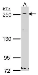 Anti-GBF1 antibody [N1], N-term used in Western Blot (WB). GTX102644