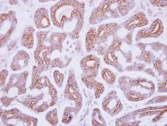 Anti-DDR2 antibody [C2C3], C-term used in IHC (Paraffin sections) (IHC-P). GTX102651
