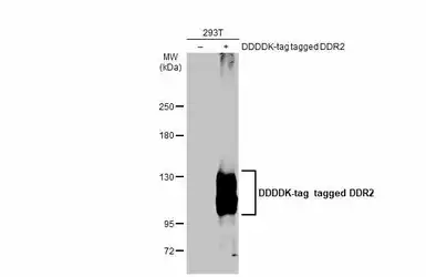 Anti-DDR2 antibody [C2C3], C-term used in Western Blot (WB). GTX102651
