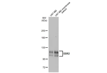 Anti-DDR2 antibody [C2C3], C-term used in Western Blot (WB). GTX102651