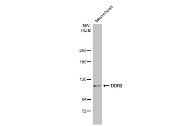 Anti-DDR2 antibody [C2C3], C-term used in Western Blot (WB). GTX102651