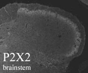 Anti-P2X2 antibody used in IHC (Frozen sections) (IHC-Fr). GTX10266