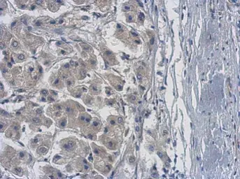Anti-PPME1 antibody used in IHC (Paraffin sections) (IHC-P). GTX102660