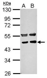 Anti-PPME1 antibody used in Western Blot (WB). GTX102660