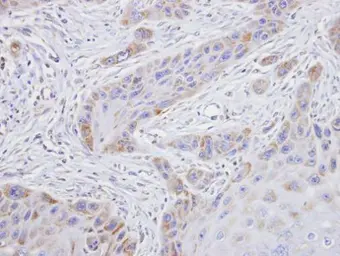 Anti-TROVE2 antibody [N2C3] used in IHC (Paraffin sections) (IHC-P). GTX102663