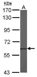 Anti-TROVE2 antibody [N2C3] used in Western Blot (WB). GTX102663