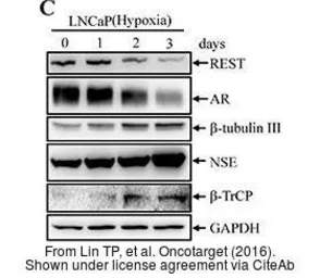 Anti-beta-TrCP antibody [N1C1] used in Western Blot (WB). GTX102667