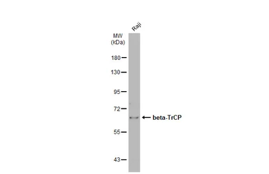 Anti-beta-TrCP antibody [N1C1] used in Western Blot (WB). GTX102667
