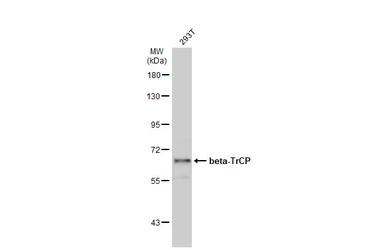 Anti-beta-TrCP antibody [N1C1] used in Western Blot (WB). GTX102667