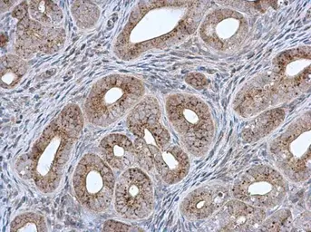 Anti-MCCC2 antibody [N1C1] used in IHC (Paraffin sections) (IHC-P). GTX102674