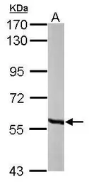 Anti-MCCC2 antibody [N1C1] used in Western Blot (WB). GTX102674