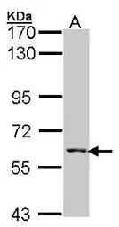 Anti-MCCC2 antibody [N1C1] used in Western Blot (WB). GTX102674