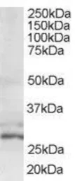 Anti-TIP30 antibody, N-term used in Western Blot (WB). GTX10268