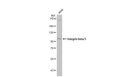 Anti-Integrin beta 5 antibody [N1C1] used in Western Blot (WB). GTX102680