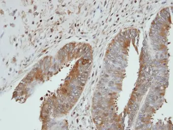 Anti-UGP2 antibody [N1C1] used in IHC (Paraffin sections) (IHC-P). GTX102684