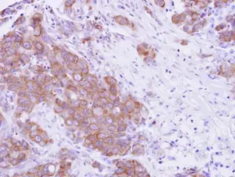 Anti-MPP3 antibody used in IHC (Paraffin sections) (IHC-P). GTX102685