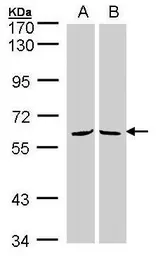 Anti-MPP3 antibody used in Western Blot (WB). GTX102685