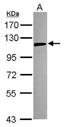 Anti-TLR5 antibody [N2C2], Internal used in Western Blot (WB). GTX102706