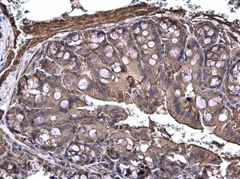 Anti-MAP3K8 antibody [N3C3] used in IHC (Paraffin sections) (IHC-P). GTX102711