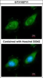 Anti-MAP3K8 antibody [N3C3] used in Immunocytochemistry/ Immunofluorescence (ICC/IF). GTX102711