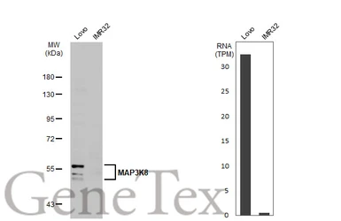 Anti-MAP3K8 antibody [N3C3] used in Western Blot (WB). GTX102711