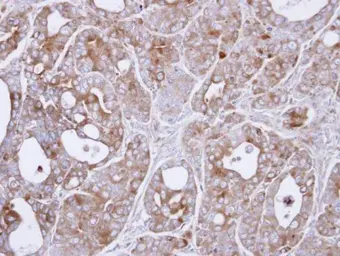 Anti-MAP3K8 antibody [N3C3] used in IHC (Paraffin sections) (IHC-P). GTX102711