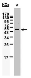 Anti-WTAP antibody used in Western Blot (WB). GTX102721