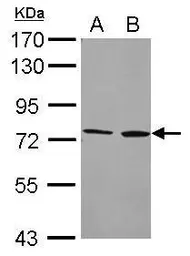 Anti-Cytochrome P450 4F2 antibody [N2C2], Internal used in Western Blot (WB). GTX102722